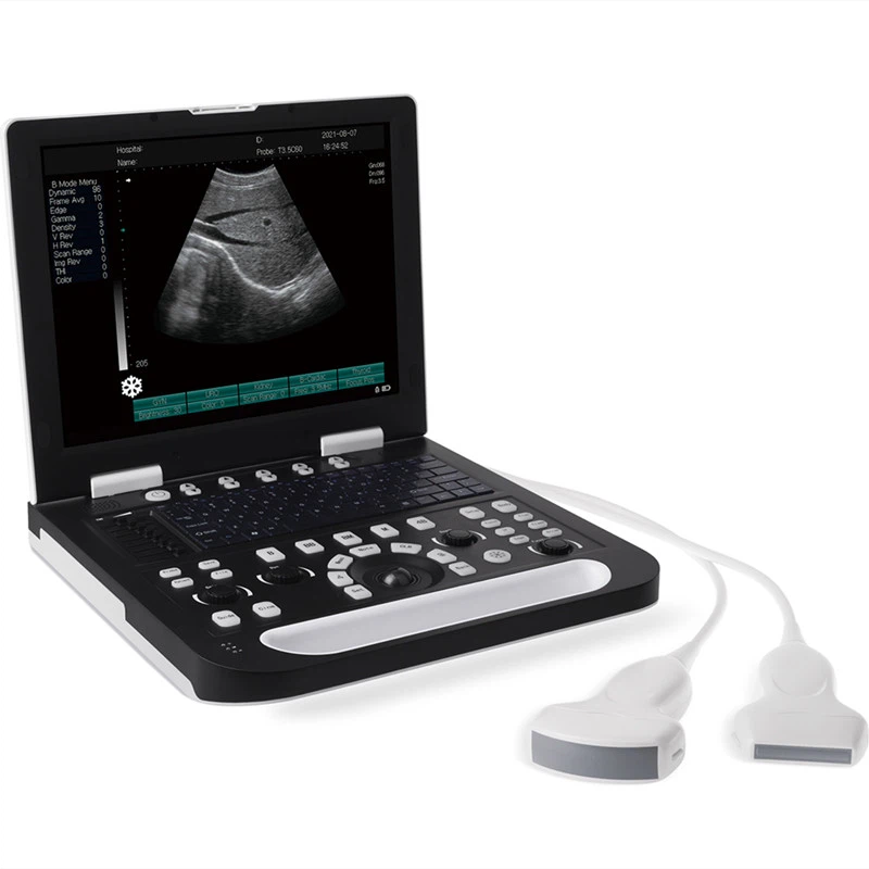 Portable Laptop Ultrasound Machine